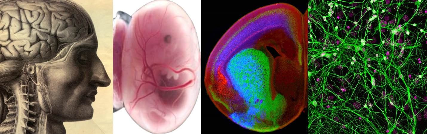 cerebral cortex projection neuron development, diversity, disease and regeneration