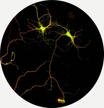 endogeneous neurogenesis