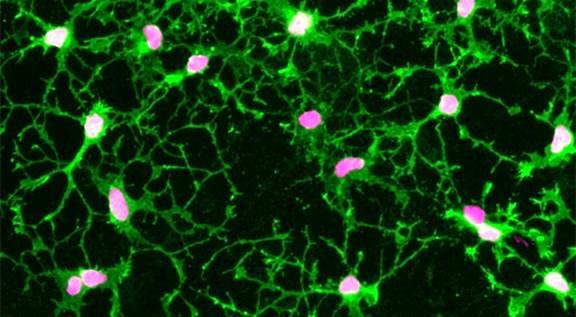 differentiated NG2 cells in culture