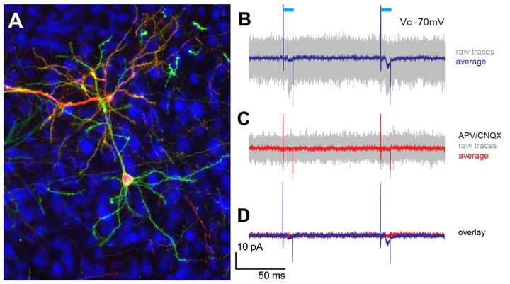 induced neurogenesis