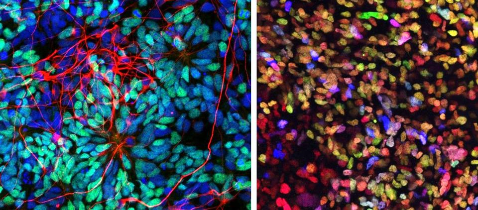 directed differentiation of pluripotent SCs